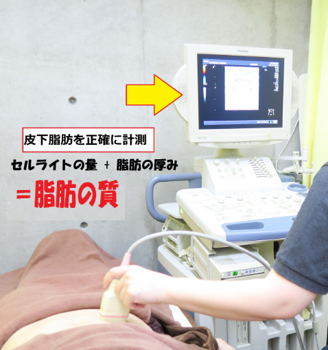 エコー