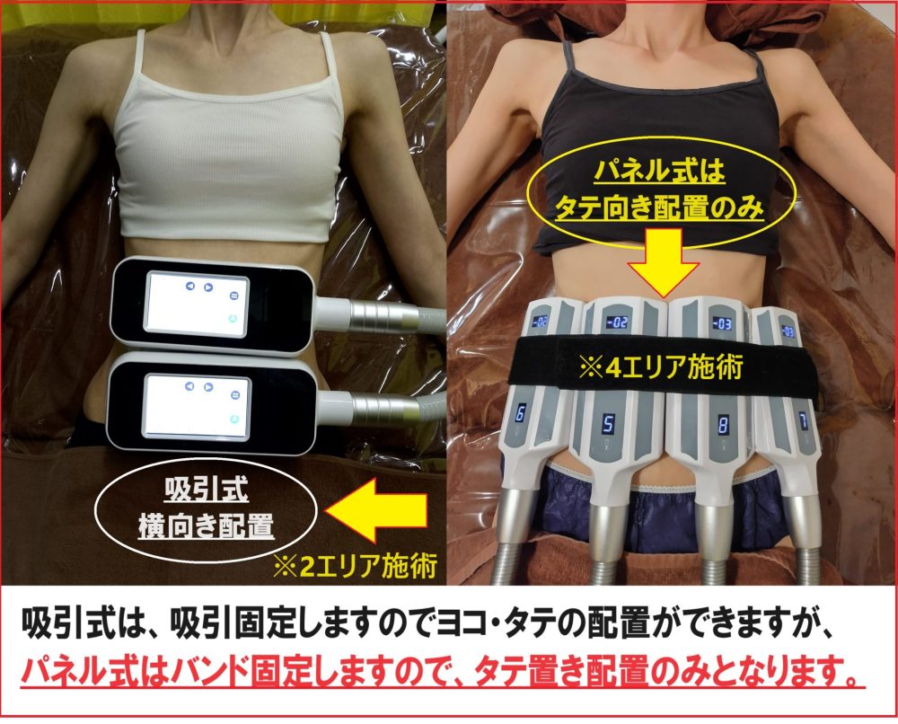脂肪冷却　マシーン　ダイエット　シート 冷却ダイエット EMSトレーニング機器（脂肪冷却用シート10枚付き